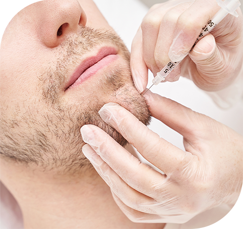 Man Taking Microneedling treatment on Chin 