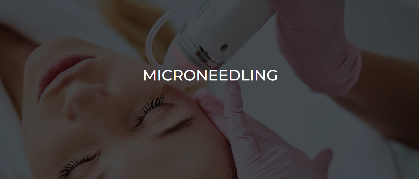 Microneedling Face/Hair NYC Syra Aesthetics™