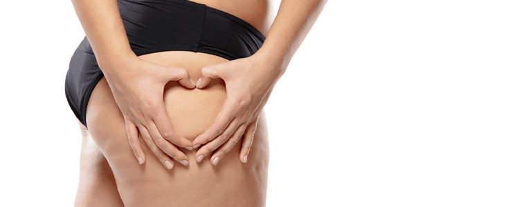 What Causes Cellulite & How Can You Get Rid Of It?