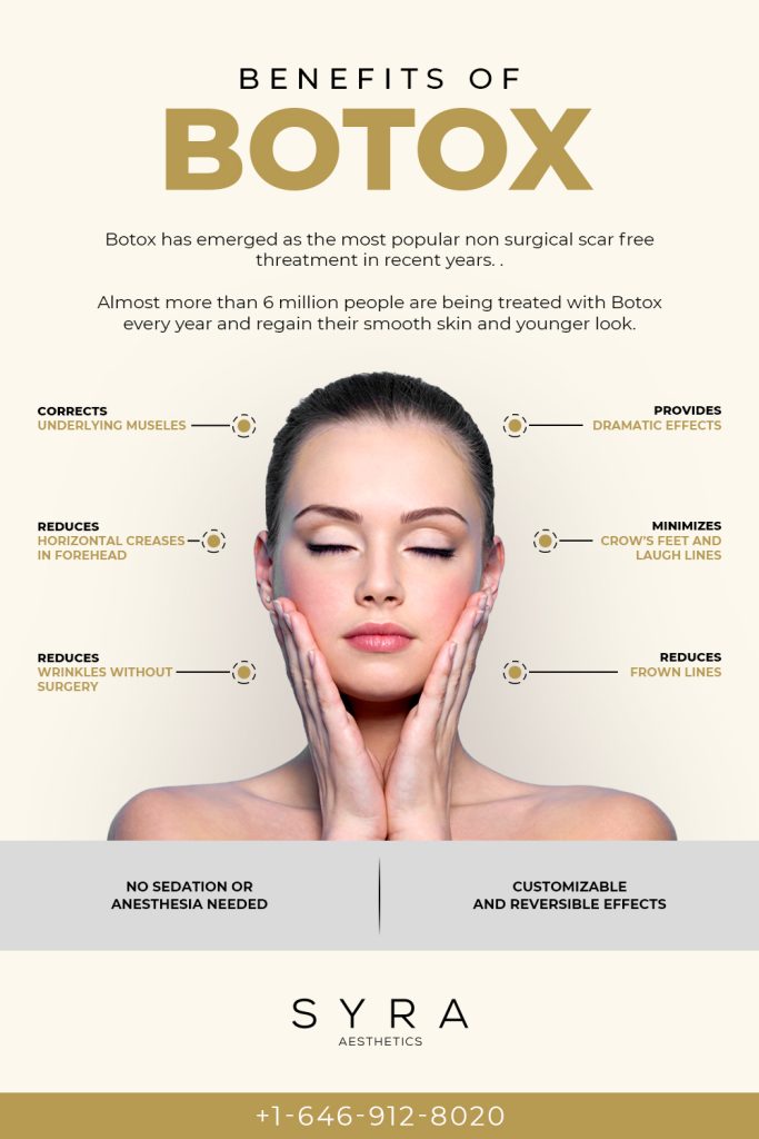 Benefits of Botox 