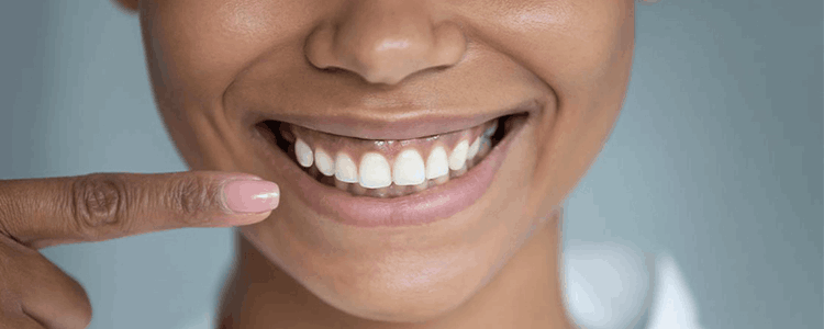 how to get rid of gummy smile