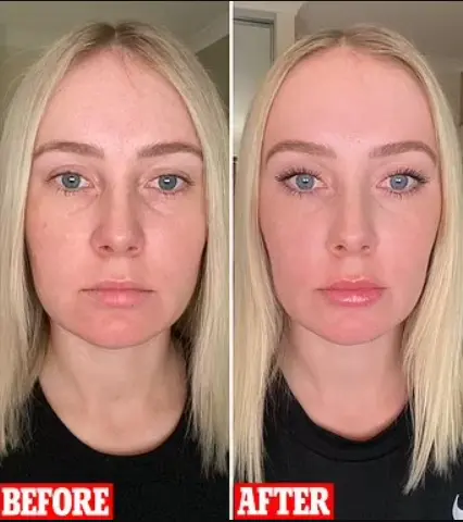 Makeup artist Lauren Curtis shows off her masseter Botox
