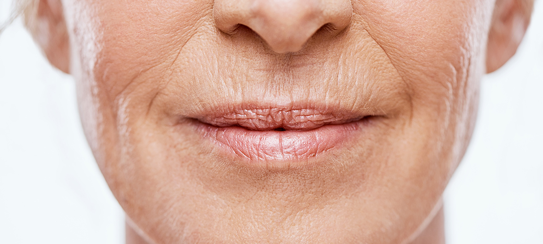 What is the Best Treatment For Deep Wrinkles On Face?