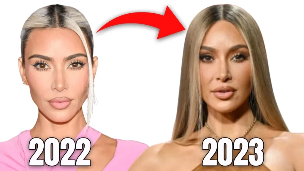 Kim Kardashian Gets Botox in Her Neck