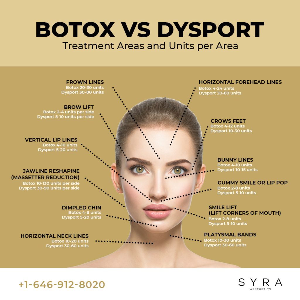 Botox Vs Dysport treatable areas and units per area