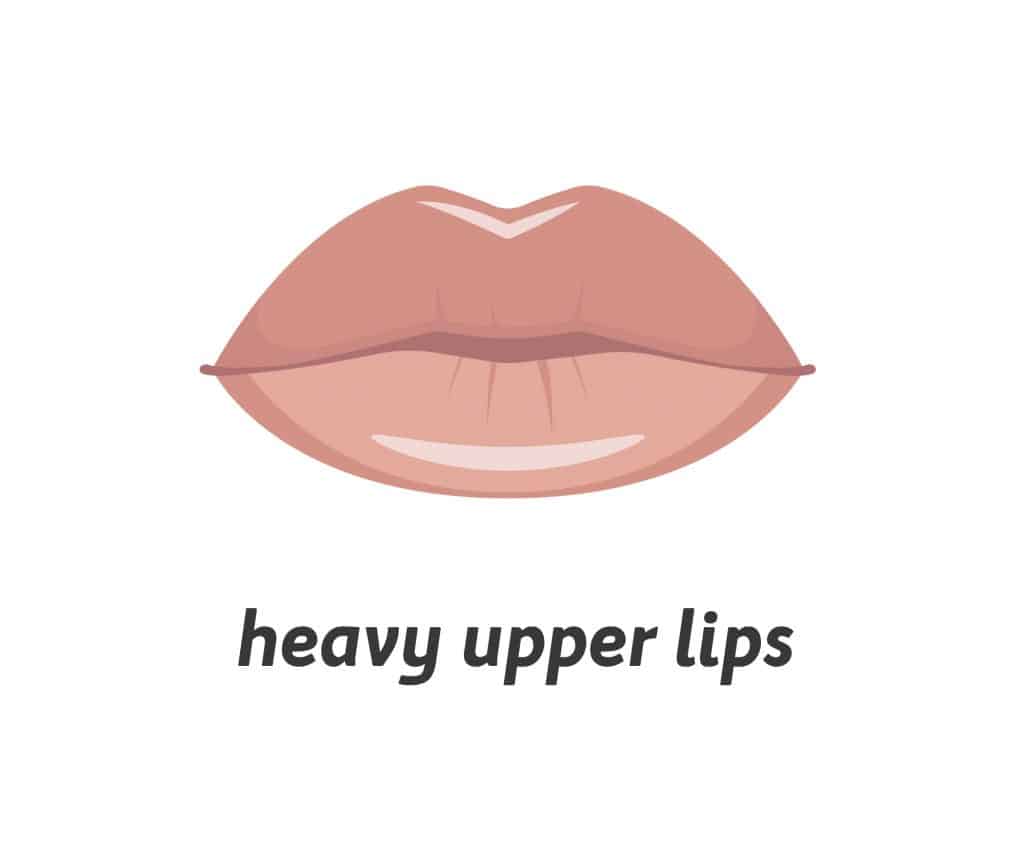 heavy-upper-lip