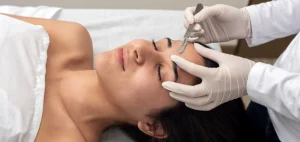 What is Dermaplaning