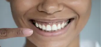 gummy smile treatment