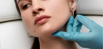 Masseters botox treatment