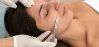 A woman receiving a dermaplaning treatment