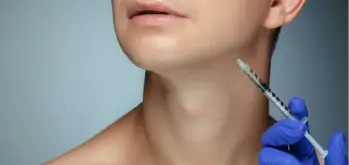 Kybella injection under the chin for fat reduction.