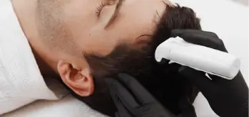 Microneedling with PEP for Hair treatment
