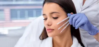 Young woman undergoing a PDO Thread Lift treatment, with threads being carefully placed along her cheek