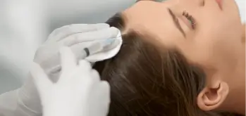 PRP Scalp Injection treatment