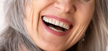 smile lines treatment area for facial sculpting