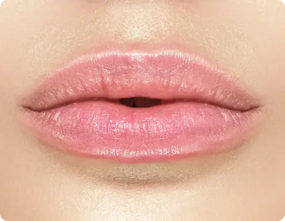 lip flip before treatment