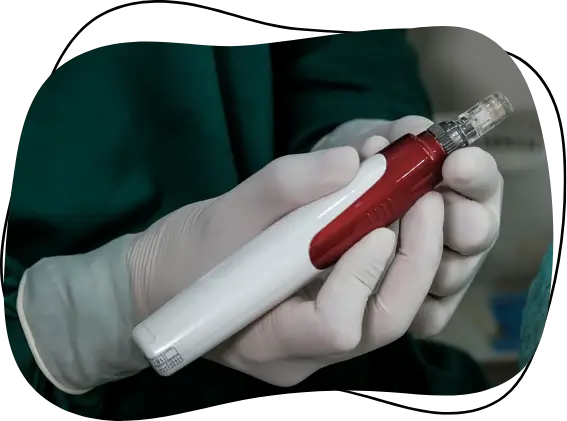 microneedling treatment enhanced by PEP Factor