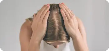 microneedling treatment for androgenetic alopecia-related hair thinning