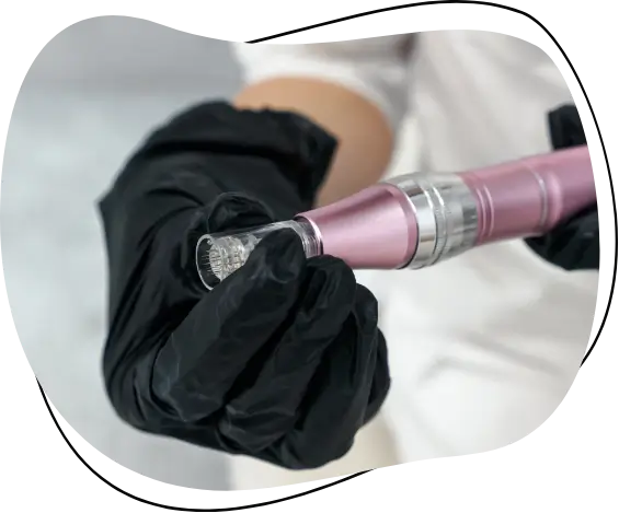 microneedling device