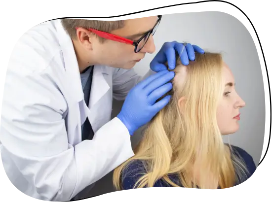 microneedling with PRP procedure for hair loss treatment in progress