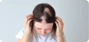 restorative microneedling treatment for scarring alopecia and damaged scalp tissue