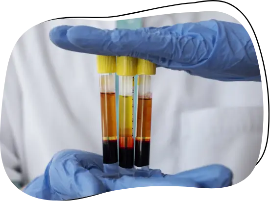 prp after microneedling